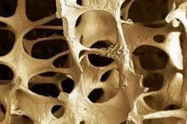 Bone Density DEXA Test in Muzaffarnagar, Best Hospital for Bone Density Test in Muzaffarnagar, Cost of Bone Density Test in Muzaffarnagar, Best DEXA Scan Centre in Uttar Pradesh