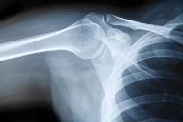 Digital X Ray in muzaffarnagar, Xray in muzaffarnagar, Most Advanced Digital X Ray in muzaffarnagar, Cost of Digital X Ray in muzaffarnagar