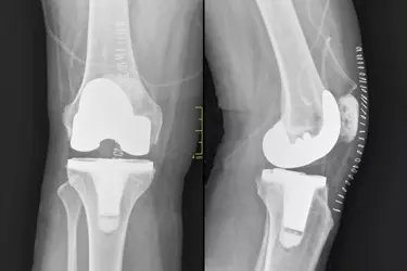 Digital X Ray in muzaffarnagar, Xray in muzaffarnagar, Most Advanced Digital X Ray in muzaffarnagar, Cost of Digital X Ray in muzaffarnagar