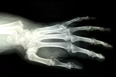 Digital X Ray in muzaffarnagar, Xray in muzaffarnagar, Most Advanced Digital X Ray in muzaffarnagar, Cost of Digital X Ray in muzaffarnagar